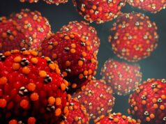 Surto de doença altamente infecciosa aumenta após show do rapper na Austrália Sarampo