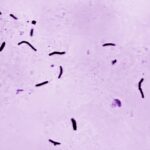 Tuberculose matou 1,23 milhão de pessoas no ano passado, diz OMS