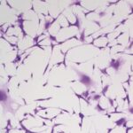 Uma descoberta fortuita leva a descobertas que salvam vidas