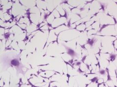 Um dos medicamentos para pressão arterial mais antigos do mundo também pode impedir o crescimento agressivo de tumores cerebrais Uma descoberta fortuita leva a descobertas que salvam vidas