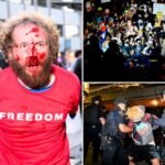 Uma briga sangrenta começa enquanto agitadores protestam contra o evento TPUSA na UC Berkeley, na Califórnia