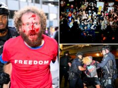 Uma briga sangrenta começa enquanto agitadores protestam contra o evento TPUSA na UC Berkeley, na Califórnia Uma briga sangrenta começa enquanto agitadores protestam contra o evento TPUSA na UC Berkeley, na Califórnia