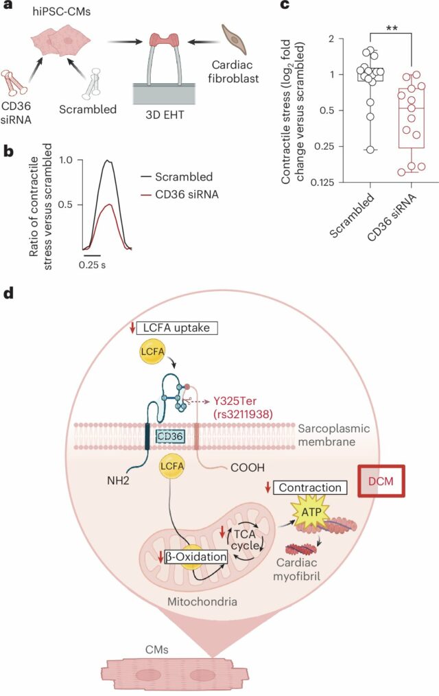 Variante genética comum associada a maior risco de doenças cardíacas Variante genética comum associada a maior risco de doenças cardíacas em pessoas com ascendência africana