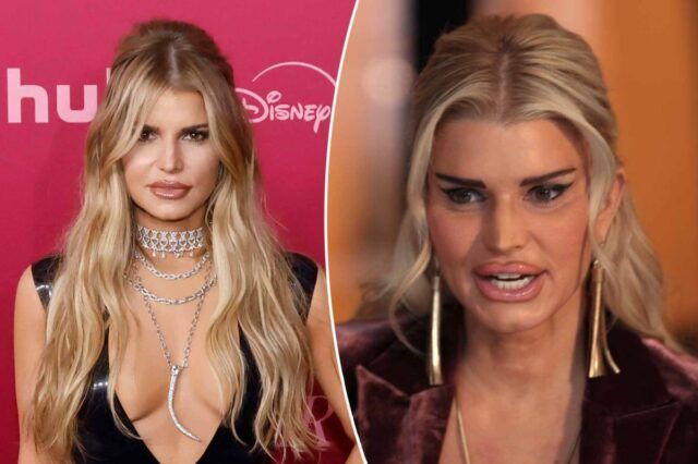 Veja o rosto de cirurgia plástica malfeita de Jessica Simpson em seu papel de atriz em 'All's Fair'
