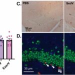 Vesículas liberadas durante o exercício que estimulam a neurogênese podem ser transplantadas