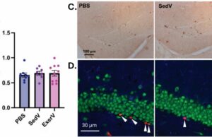 Vesículas induzidas por exercício aumentam o crescimento de neurônios quando transplantadas em camundongos sedentários Vesículas liberadas durante o exercício que estimulam a neurogênese podem ser transplantadas