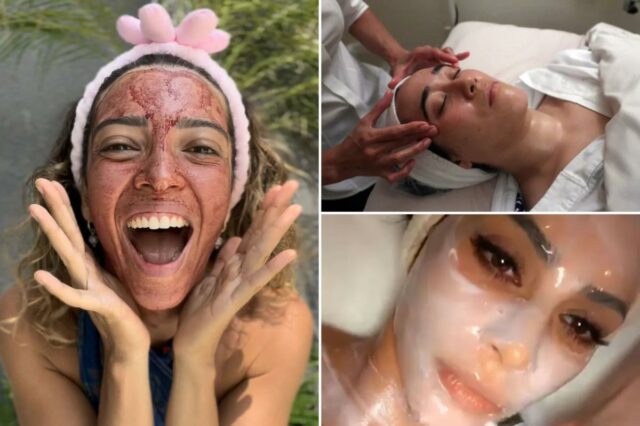 5 tratamentos malucos para a pele que você esqueceu, desde 5 tratamentos malucos para a pele que você esqueceu, desde o ‘tratamento facial com cocô de pássaro’ até a terapia com ‘placenta de ovelha’