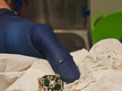 A polícia recupera um pingente Fabergé engolido após uma espera de 6 dias para que ele reapareça Yahoo news home