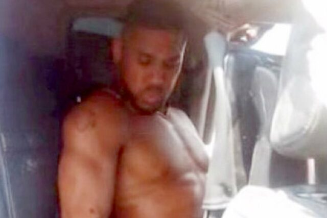 Anthony Joshua em imagens das consequências do incidente (Adeniyi Orojo)