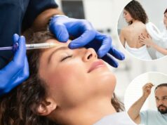 As pessoas estão recebendo Botox e tratamentos faciais cobertos por seu trabalho com este benefício para a saúde da pele As pessoas estão recebendo Botox e tratamentos faciais cobertos por seu trabalho com este benefício para a saúde da pele
