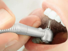 Bactéria oral pode piorar a incapacidade em pacientes com esclerose múltipla: Estudo Bactéria oral pode piorar a incapacidade em pacientes com esclerose múltipla: Estudo