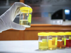 Cientistas fazem descobertas perturbadoras em amostras de urina humana: ‘Precisamos classificar (isto) urgentemente’ Yahoo news home