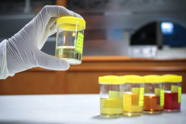 Cientistas fazem descobertas perturbadoras em amostras de urina humana: ‘Precisamos Yahoo news home