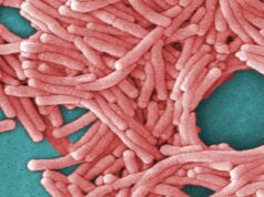 Cresce surto de doença dos legionários em Sydney CBD Cresce surto de doença dos legionários em Sydney CBD