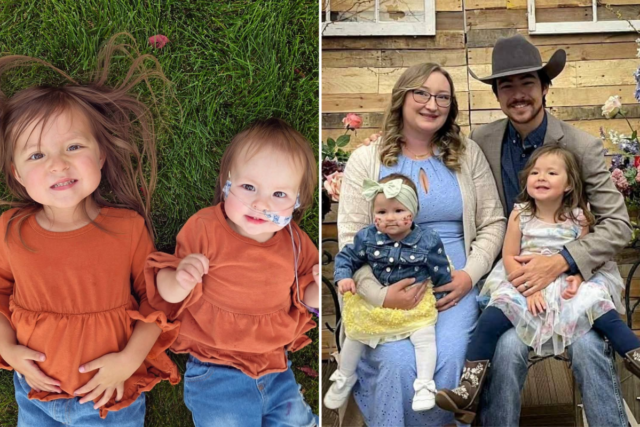 Criança deixa cair irmãzinha, testes de emergência mudam tudo: ‘Nós a teríamos perdido’
