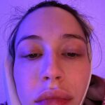 Elsie Hewitt remove os dentes do siso
