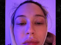 Elsie Hewitt fez uma cirurgia para remover o dente do siso um dia após o parto Elsie Hewitt remove os dentes do siso