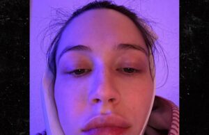 Elsie Hewitt fez uma cirurgia para remover o dente do siso um dia após o parto Elsie Hewitt remove os dentes do siso