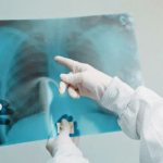 Estudo do IIT Bombay mostra como as bactérias da TB se protegem dos antibióticos