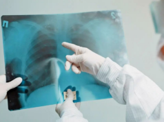 Estudo do IIT Bombay mostra como as bactérias da TB se protegem dos antibióticos Estudo do IIT Bombay mostra como as bactérias da TB se protegem dos antibióticos