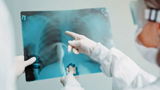 Estudo do IIT Bombay mostra como as bactérias da TB Estudo do IIT Bombay mostra como as bactérias da TB se protegem dos antibióticos