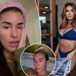 Jessie James Decker luta contra uma doença bizarra com inchaço facial e problemas respiratórios