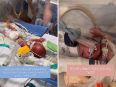 Mãe dá à luz a filha às 23 semanas, a luta dela muda tudo Mãe dá à luz a filha às 23 semanas, a luta dela muda tudo