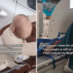 Mãe tem cesariana traumática, 2 semanas depois percebe que a cabeça do bebê não está normal