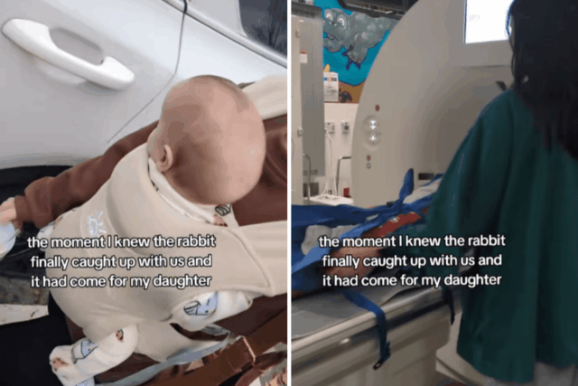 Mãe tem cesariana traumática, 2 semanas depois percebe que a Mãe tem cesariana traumática, 2 semanas depois percebe que a cabeça do bebê não está normal