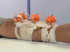 Médicos de Gaza usam tecnologia 3D para salvar membros quebrados por Israel da amputação Médicos de Gaza usam 3D