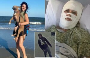 Mulher que frequentava a igreja na Geórgia, 46 anos, sofreu queimaduras graves em ataque químico tóxico aleatório enquanto caminhava no parque Mulher que frequentava a igreja na Geórgia, 46 anos, sofreu queimaduras graves em ataque químico tóxico aleatório enquanto caminhava no parque