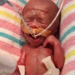 bebê Charlie Jones é o menor recém-nascido de Queensland