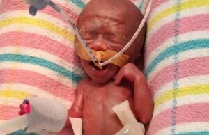 O pequeno recém-nascido Charlie bate recorde como o menor bebê de Queensland bebê Charlie Jones é o menor recém-nascido de Queensland