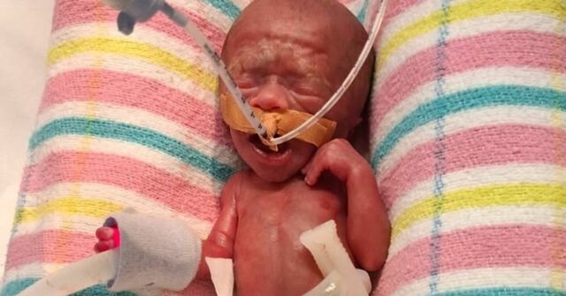 O pequeno recém-nascido Charlie bate recorde como o menor bebê bebê Charlie Jones é o menor recém-nascido de Queensland