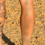 Um homem foi acusado de tatuagens nazistas que exibiu em uma praia em Newcastle.