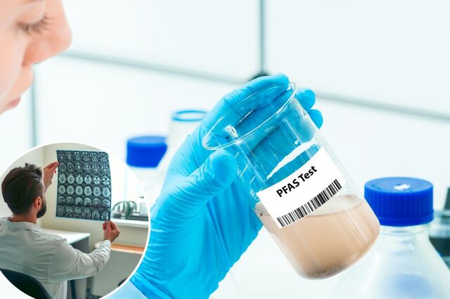 'Produtos químicos para sempre' ligados a outra condição devastadora para 'Produtos químicos para sempre' ligados a outra condição devastadora para toda a vida: estudo