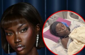 Supermodelo Anok Yai diagnosticada com defeito pulmonar congênito Anok-Yai-ig-getty-1