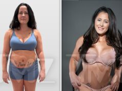 ‘Teen Mom’ Jenelle Evans estreia Mommy Makeover, veja fotos de antes e depois Janelle Evans recebe apostila de reforma da mamãe 1