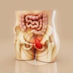 Você tem medo de que seu filho fique infértil devido a uma cirurgia de hérnia? Isto é o que o médico disse