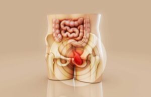 Você tem medo de que seu filho fique infértil devido a uma cirurgia de hérnia? Isto é o que o médico disse Você tem medo de que seu filho fique infértil devido a uma cirurgia de hérnia? Isto é o que o médico disse