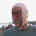 ‘Um massacre absoluto’: homem ferido em tiroteio em Bondi Beach fala do caos