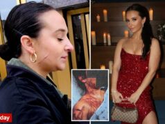 A ex-assessora do Partido Republicano de NJ ainda carrega cicatrizes visíveis depois de pagar a um artista fetichista para cortá-la como parte da farsa do ataque de Trump A ex-assessora do Partido Republicano de NJ ainda carrega cicatrizes visíveis depois de pagar a um artista fetichista para cortá-la como parte da farsa do ataque de Trump