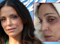 Bethenny Frankel contrai infecção bacteriana após festa em St. betheny frankel rash getty comp
