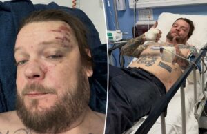 Corey Harrison de ‘Pawn Stars’ quebra 11 costelas em acidente de moto assustador Corey Harrison de 'Pawn Stars' quebra 11 costelas em acidente de moto assustador
