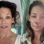 Evangeline Lilly compartilha plano de tratamento após traumatismo cranioencefálico: ‘Gastei muito dinheiro’