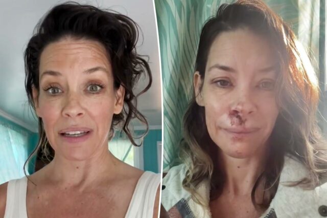 Evangeline Lilly compartilha plano de tratamento após traumatismo cranioencefálico: ‘Gastei muito dinheiro’
