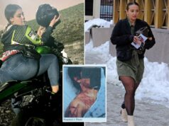 Ex-assessora do Partido Republicano de NJ que se mutilou em falso ataque anti-Trump planeja um ‘novo começo’ com um amigo legalmente problemático da Flórida Ex-assessora do Partido Republicano de NJ que se mutilou em falso ataque anti-Trump planeja um 'novo começo' com um amigo legalmente problemático da Flórida