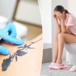 Um cosmetologista removendo uma tatuagem de rosa do ombro de um paciente usando um laser de neodímio.