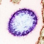 O vírus Nipah é frequentemente fatal e pode causar danos cerebrais aos sobreviventes.