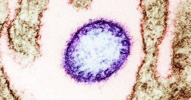 Governo australiano 'monitora' o vírus Nipah de perto O vírus Nipah é frequentemente fatal e pode causar danos cerebrais aos sobreviventes.